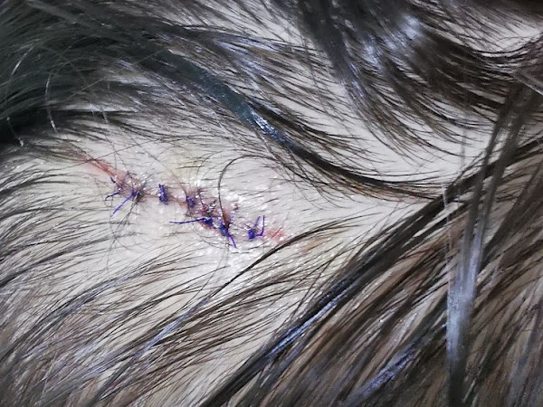 Patient review photo