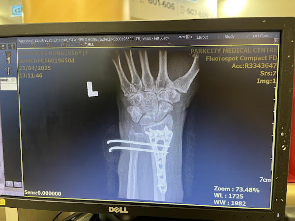 Patient review photo